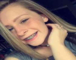 She used to wear braces.